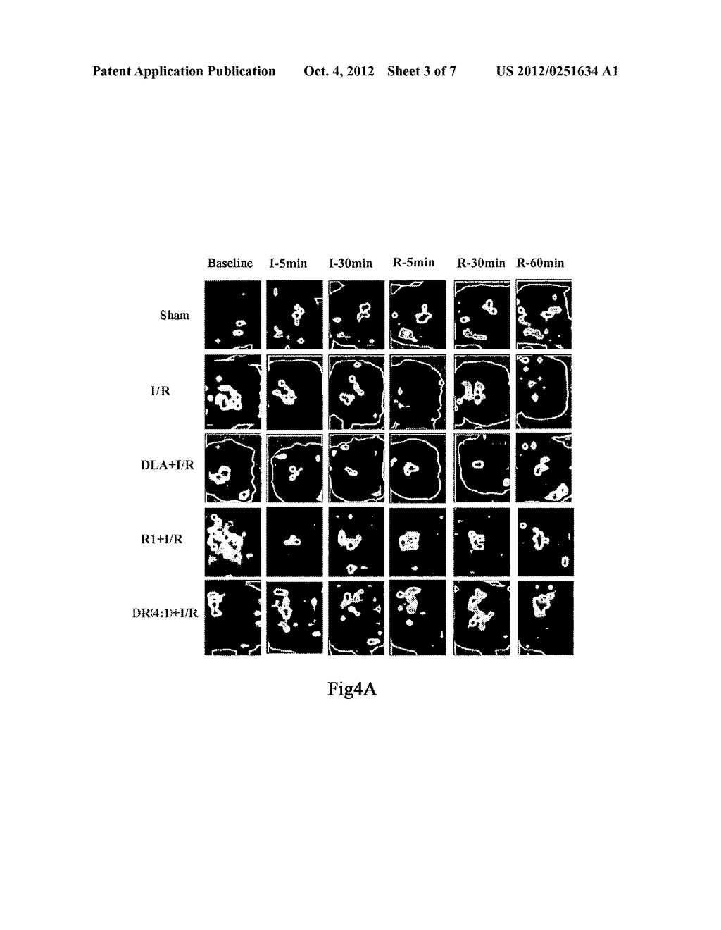 TRADITIONAL CHINESE DRUG COMPRISING DANSHEN EXTRACTS AND SANQI EXTRACTS     AND USE THEREOF - diagram, schematic, and image 04