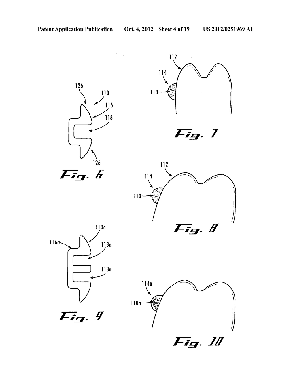 METHOD OF FORMING AN ORTHODONTIC TRANSFER TRAY - diagram, schematic, and image 05