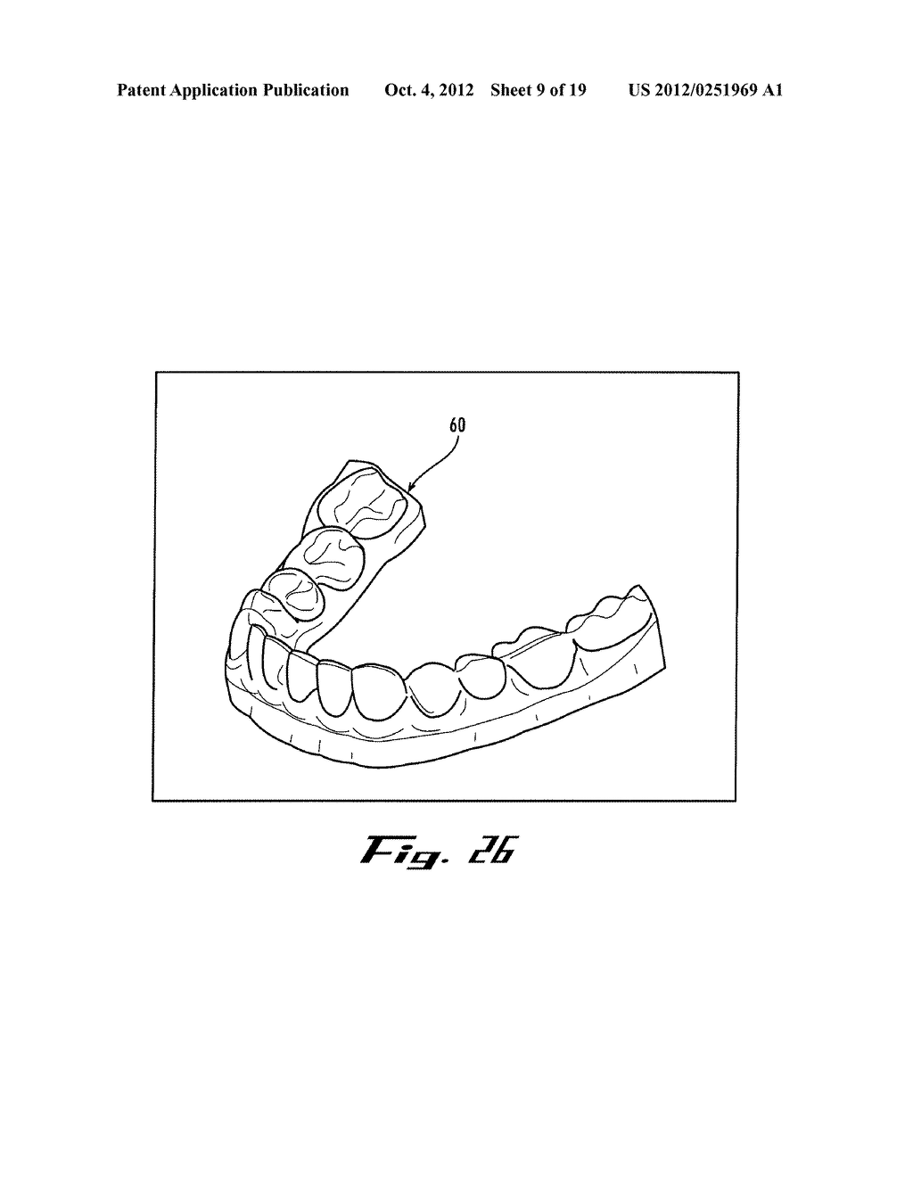 METHOD OF FORMING AN ORTHODONTIC TRANSFER TRAY - diagram, schematic, and image 10
