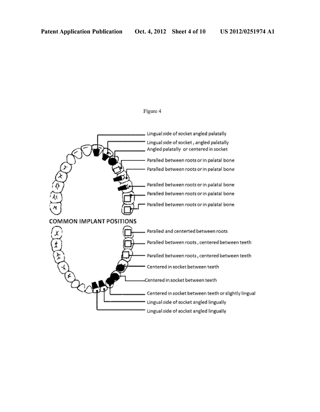 METHOD AND KIT FOR DENTAL IMPLANT DRILLING GUIDES - diagram, schematic, and image 05