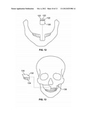 Method of Forming Patient Specific Implants with Improved Osseointegration diagram and image