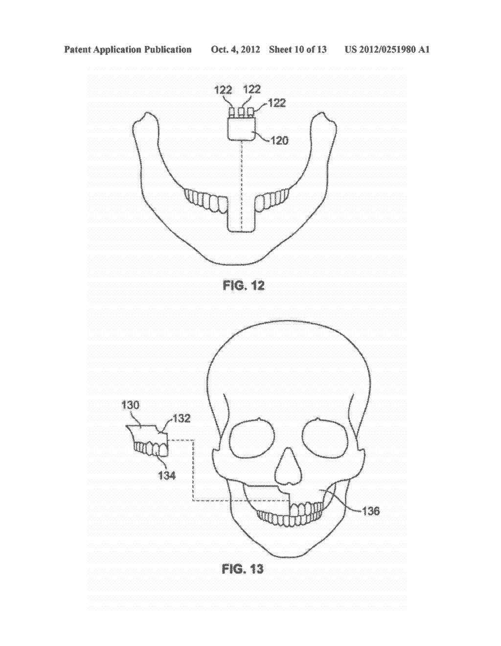 Method of Forming Patient Specific Implants with Improved Osseointegration - diagram, schematic, and image 11