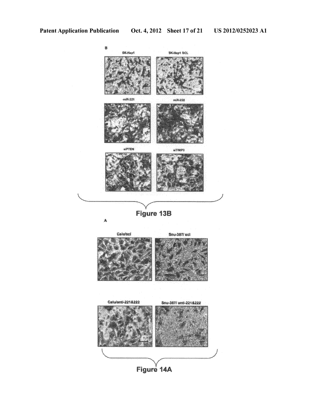 Materials and Methods Useful for Affecting Tumor Cell Growth, Migration     and Invasion - diagram, schematic, and image 18