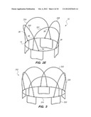 TRAMPOLINE WITH COLLAPSIBLE ENCLOSURE ASSEMBLY diagram and image