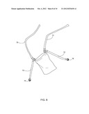 Method and Device for Facilitating Use of an Exercise Ball diagram and image