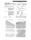 MITF AS A MARKER FOR PREDISPOSITION TO CANCER diagram and image