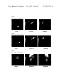 COMPOUND ACCUMULATING IN INFLAMMATORY SITE, DIAGNOSTIC AGENT CONTAINING     THE COMPOUND IN LABELED STATE AND ITS PRECURSOR COMPOUND FOR LABELING diagram and image