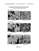 HANDHELD CELL EXCITATION TERMINAL CAPABLE OF DYNAMIC OPTIMIZATION OF     THERAPEUTIC EFFECT AND REMOTE THERAPEUTIC SYSTEM diagram and image