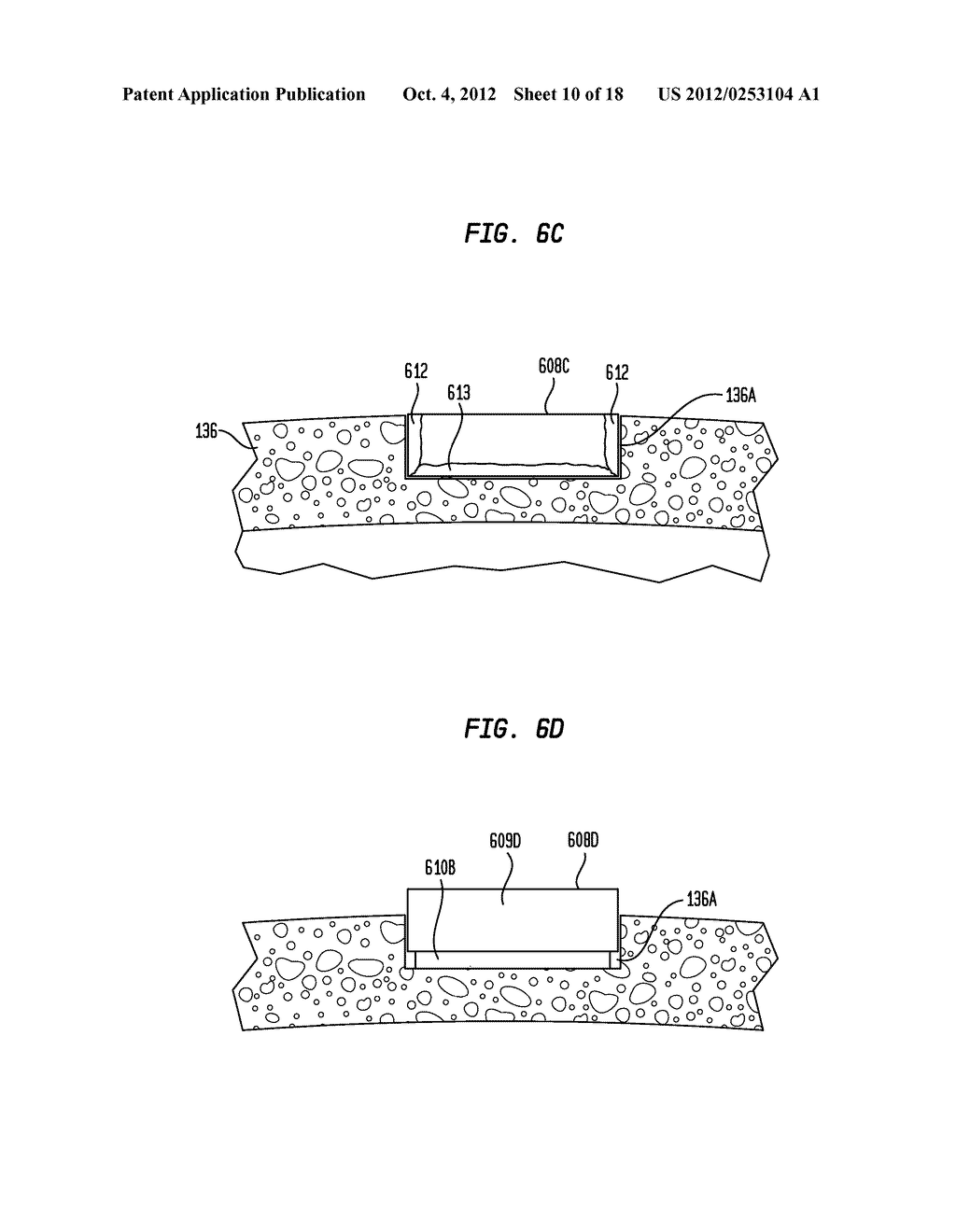 HEARING PROSTHESIS WITH A PIEZOELECTRIC ACTUATOR - diagram, schematic, and image 11