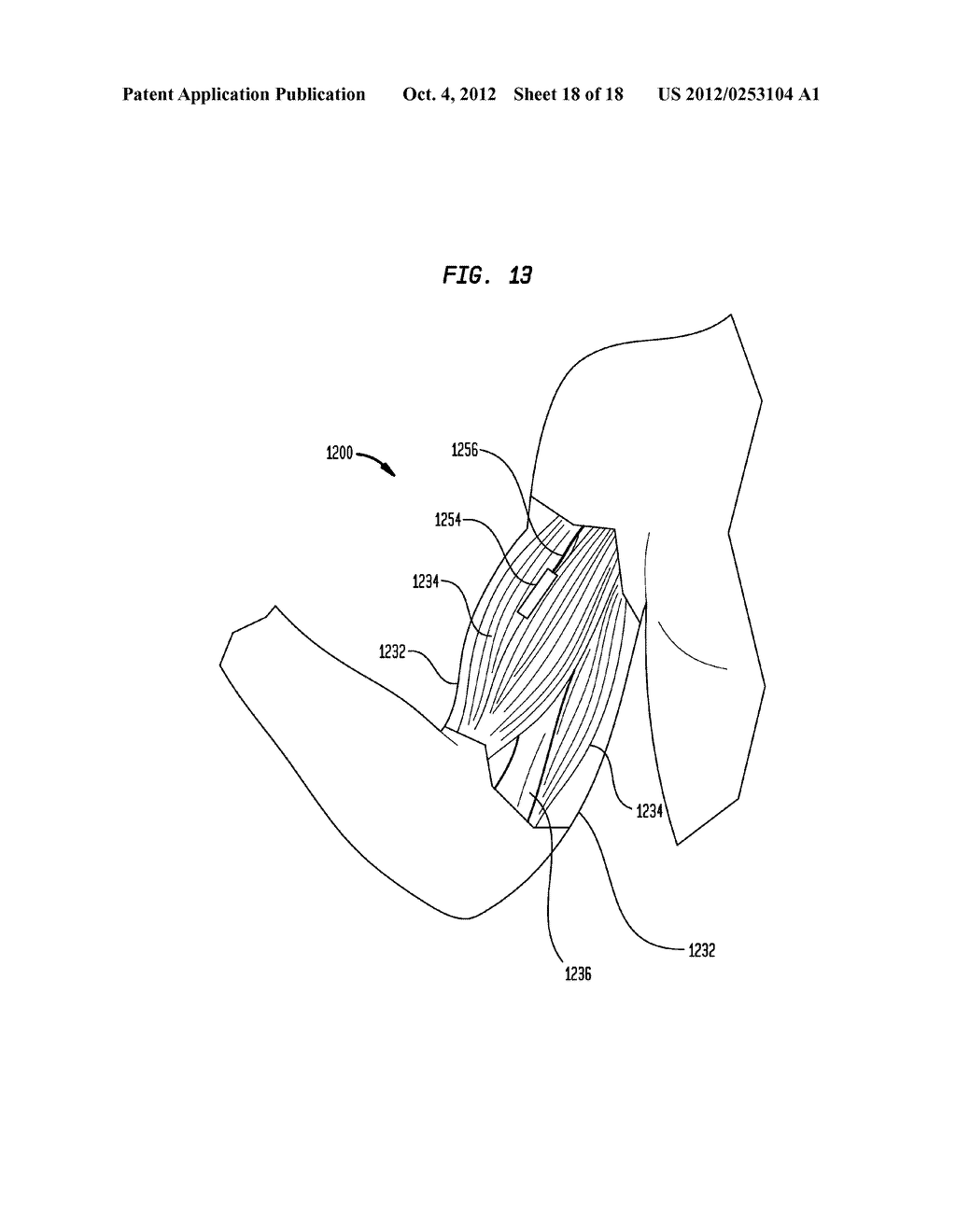 HEARING PROSTHESIS WITH A PIEZOELECTRIC ACTUATOR - diagram, schematic, and image 19