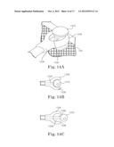 CARDIAC SUPPORT DEVICE DELIVERY TOOL WITH RELEASE MECHANISM diagram and image