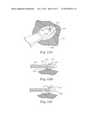 CARDIAC SUPPORT DEVICE DELIVERY TOOL WITH RELEASE MECHANISM diagram and image