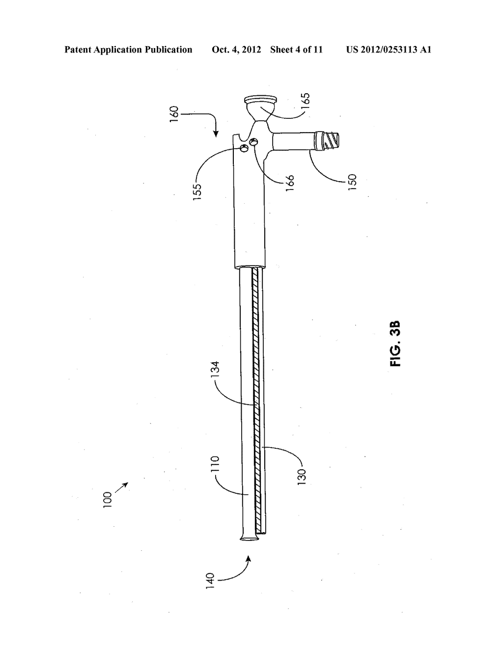 Devices, Systems, and Methods for Removing Empyema from a Pleural Cavity - diagram, schematic, and image 05