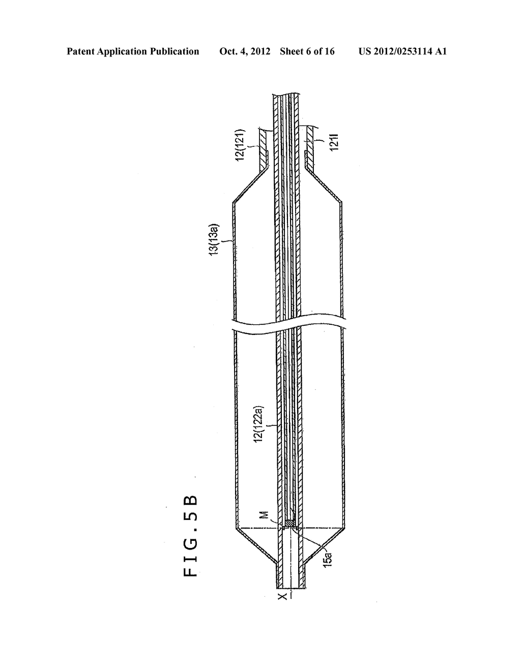 OTORHINOLARYNGOLOGICAL TREATMENT DEVICE AND METHOD - diagram, schematic, and image 07