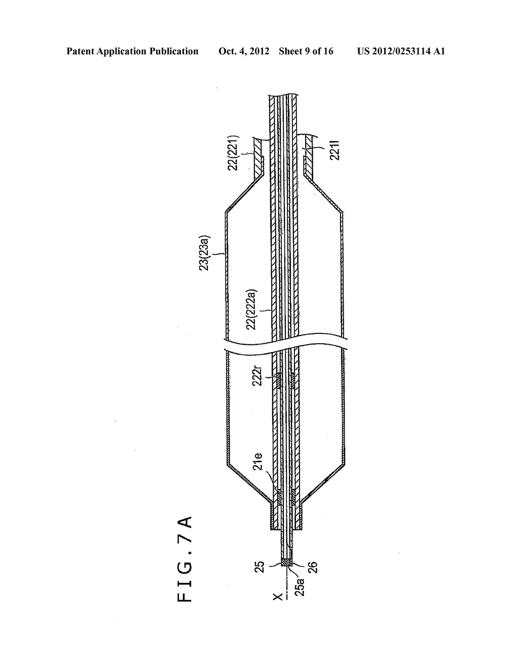 OTORHINOLARYNGOLOGICAL TREATMENT DEVICE AND METHOD - diagram, schematic, and image 10