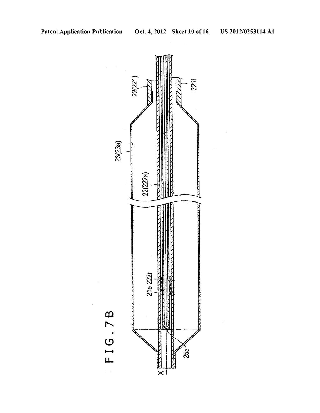 OTORHINOLARYNGOLOGICAL TREATMENT DEVICE AND METHOD - diagram, schematic, and image 11