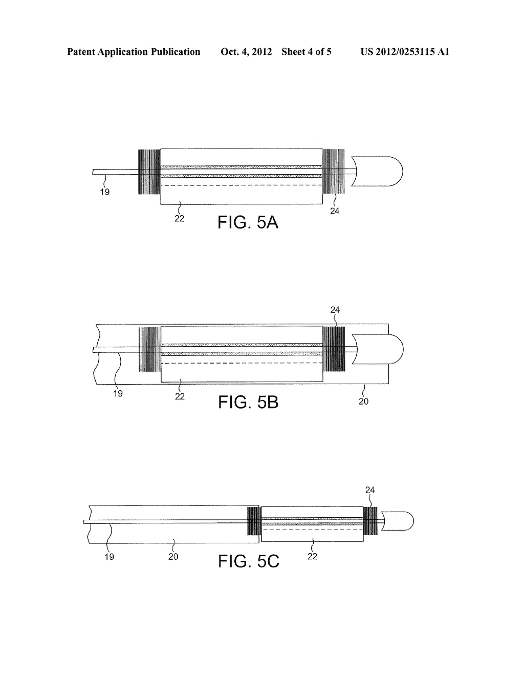 ENDOSCOPIC SYSTEM - diagram, schematic, and image 05