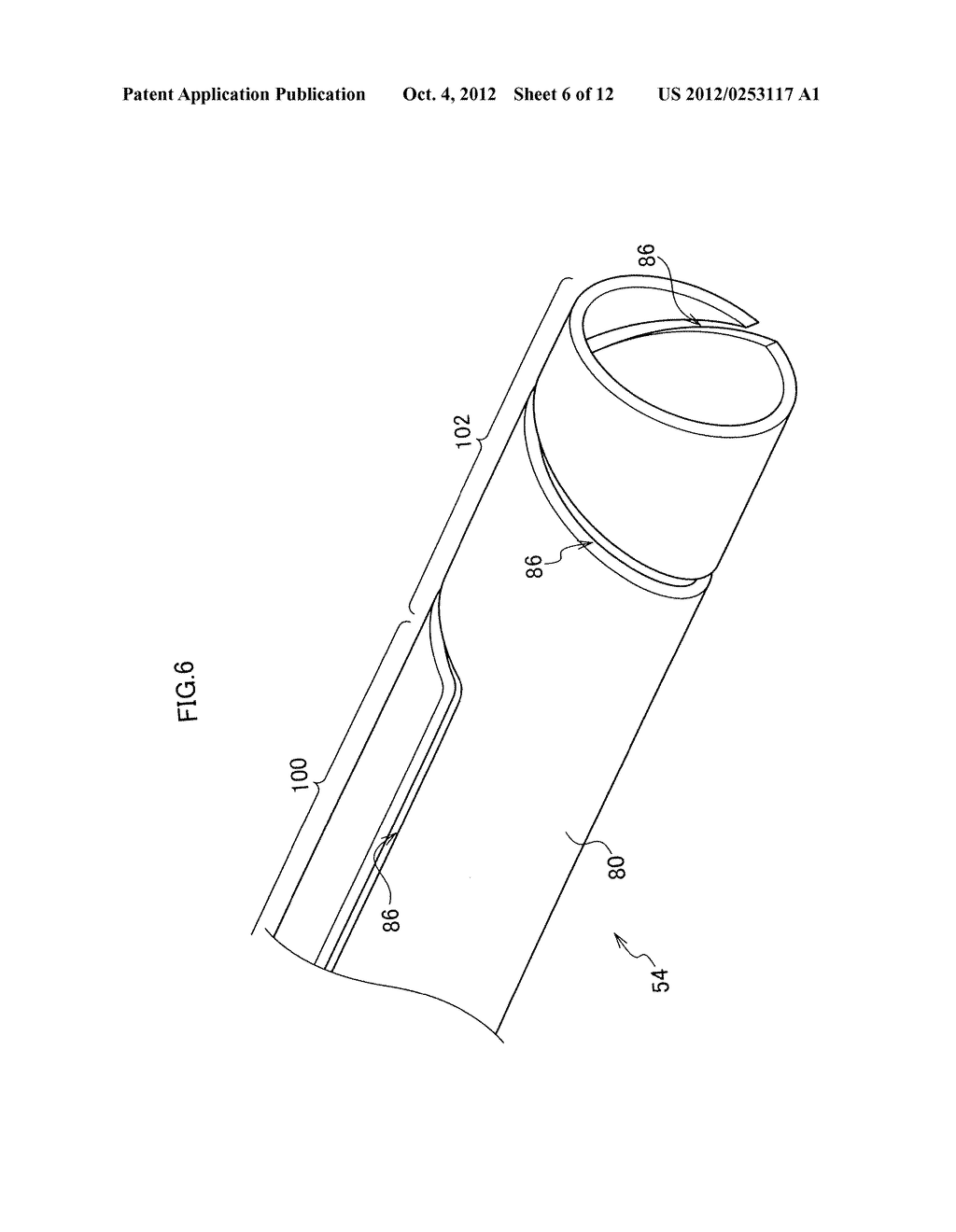 DRAINAGE TUBE INSERTION TOOL - diagram, schematic, and image 07