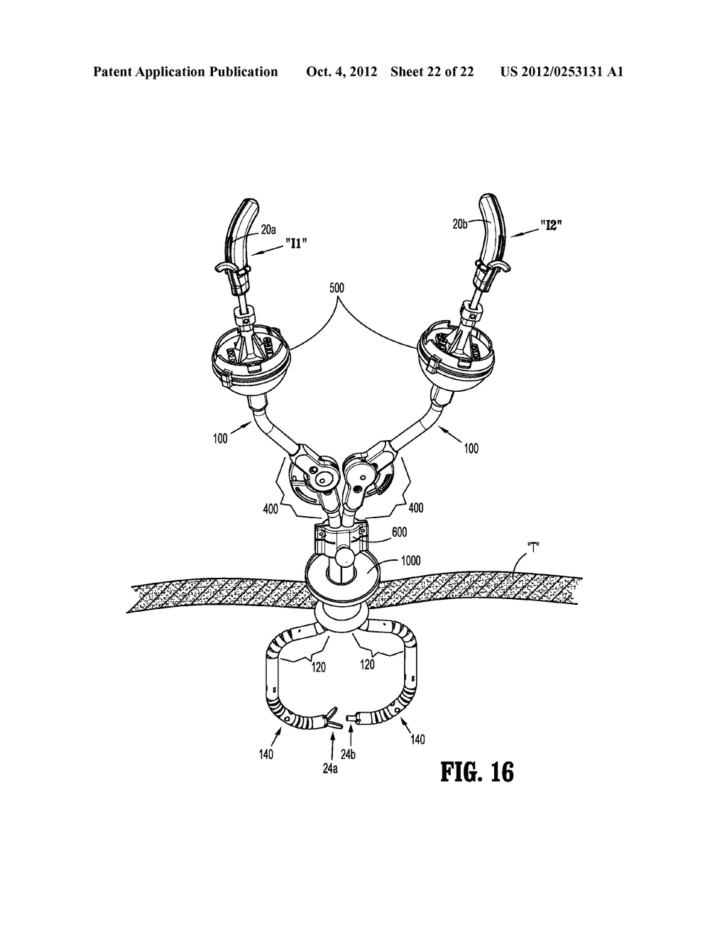 Articulating Surgical Access System For Laparoscopic Surgery - diagram, schematic, and image 23