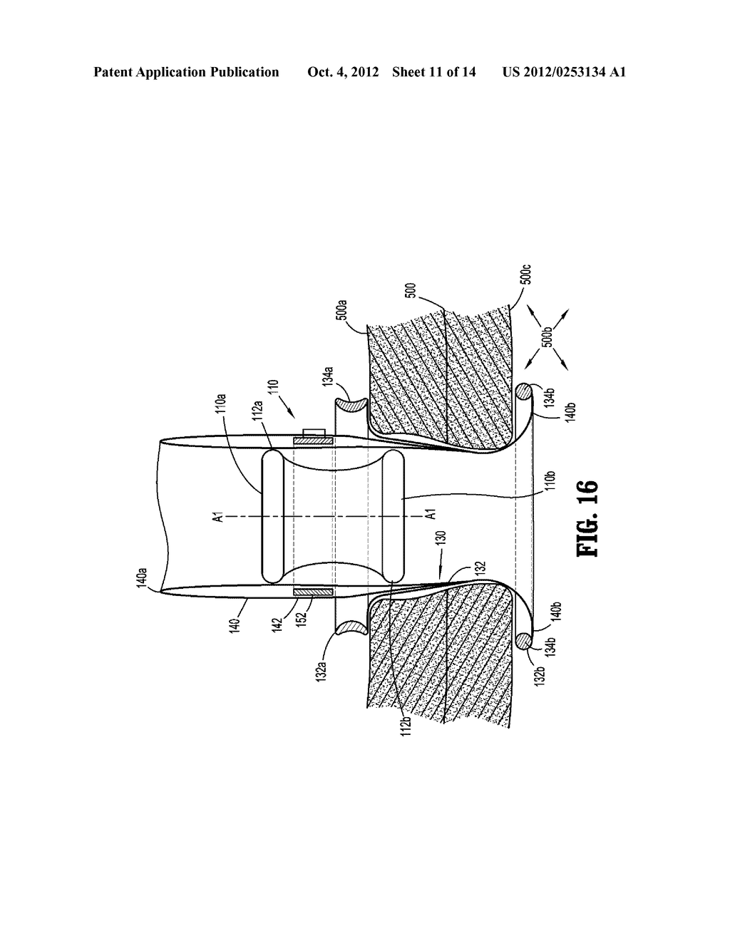 SURGICAL ACCESS ASSEMBLY WITH SLEEVE AND ADJUSTABLE FASTENER - diagram, schematic, and image 12