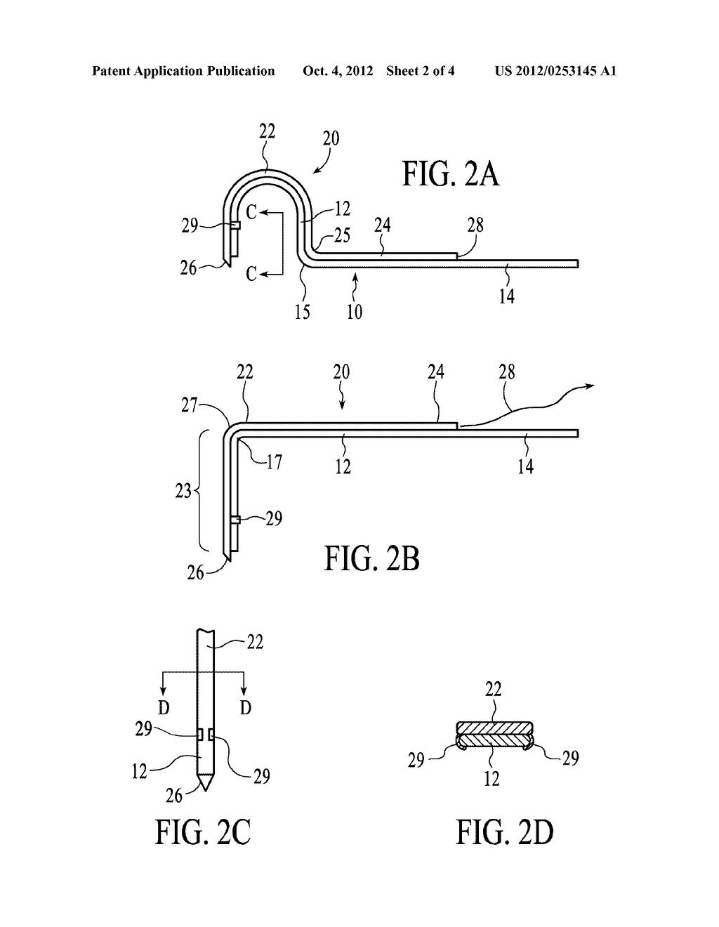 Systems and Methods for Transcutaneously Implanting Medical Devices - diagram, schematic, and image 03