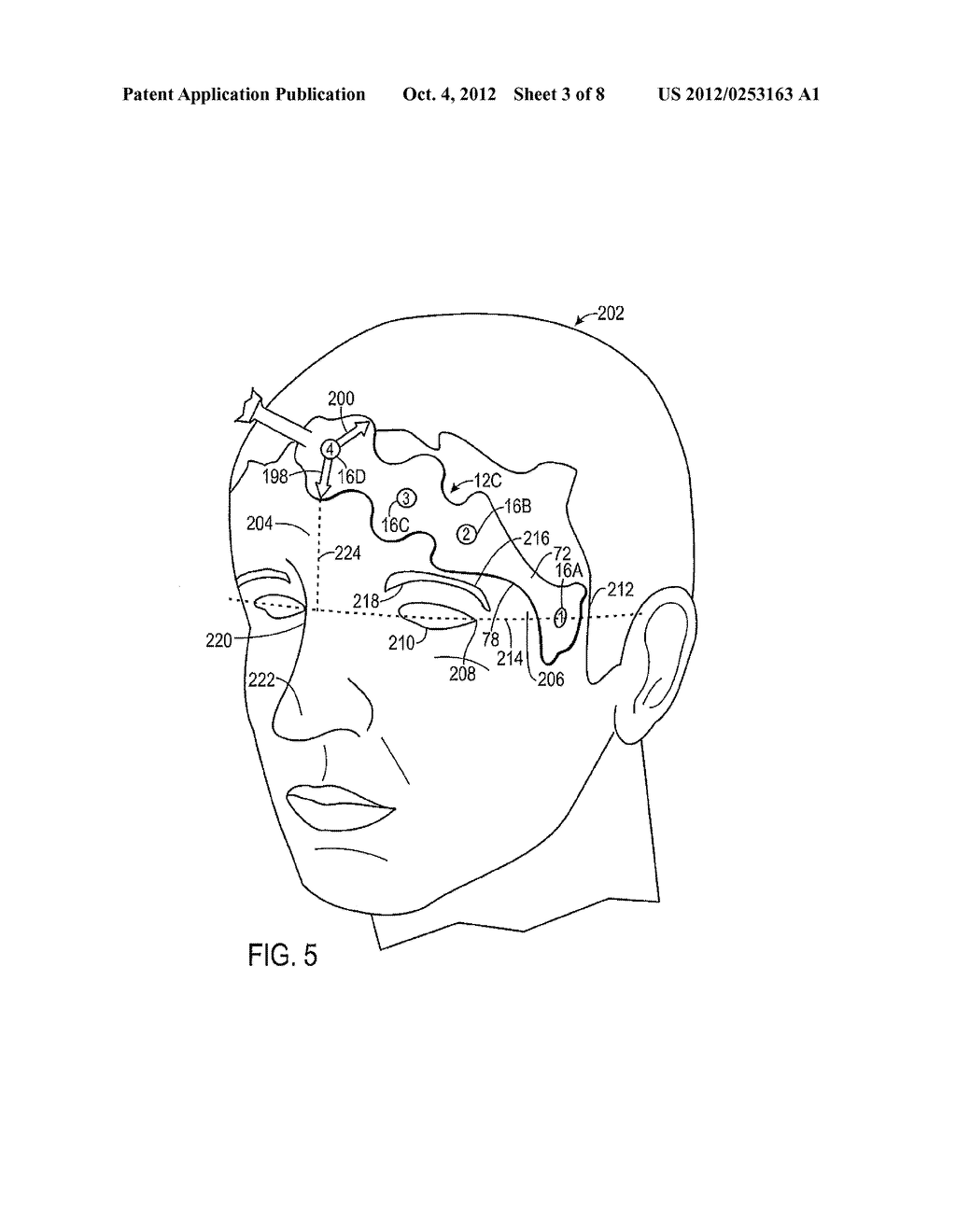 METHOD AND SYSTEM FOR POSITIONING A SENSOR - diagram, schematic, and image 04