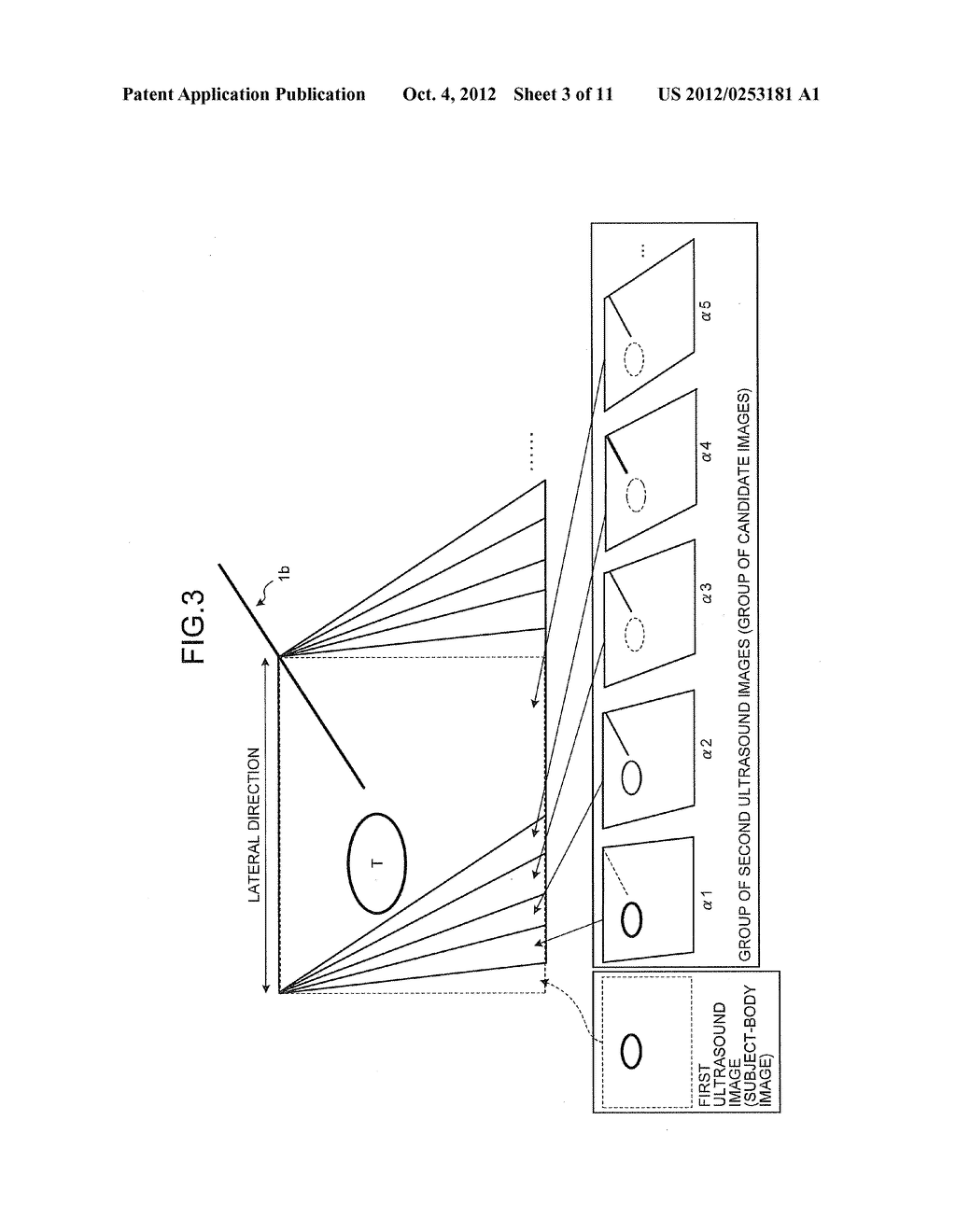 ULTRASOUND DIAGNOSIS APPARATUS AND CONTROLLING METHOD - diagram, schematic, and image 04