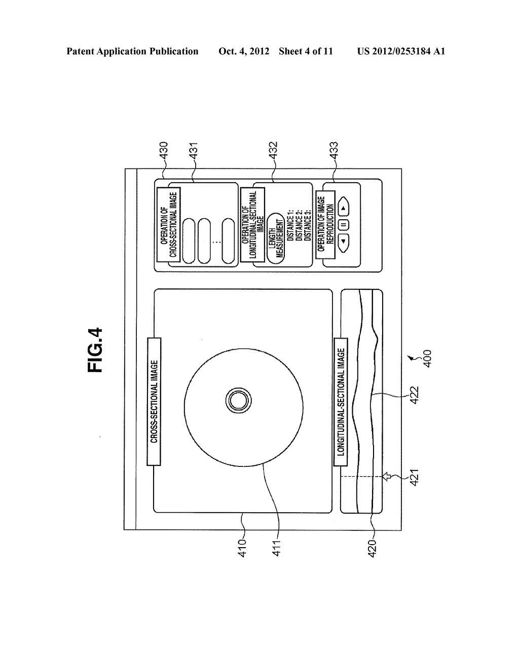 IMAGING APPARATUS FOR DIAGNOSIS AND DISPLAY METHOD - diagram, schematic, and image 05