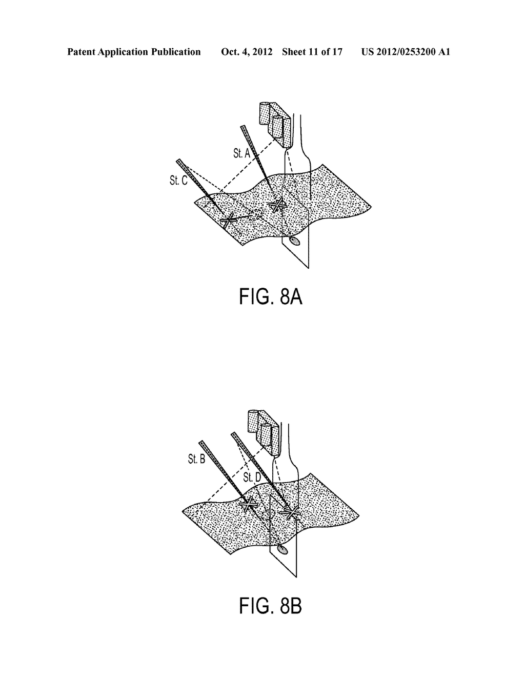 LOW-COST IMAGE-GUIDED NAVIGATION AND INTERVENTION SYSTEMS USING     COOPERATIVE SETS OF LOCAL SENSORS - diagram, schematic, and image 12