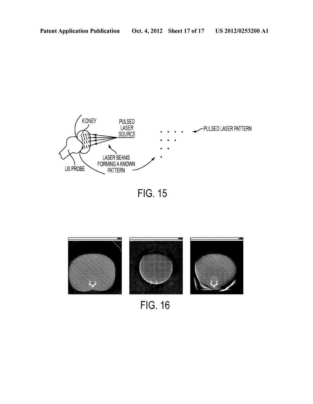 LOW-COST IMAGE-GUIDED NAVIGATION AND INTERVENTION SYSTEMS USING     COOPERATIVE SETS OF LOCAL SENSORS - diagram, schematic, and image 18