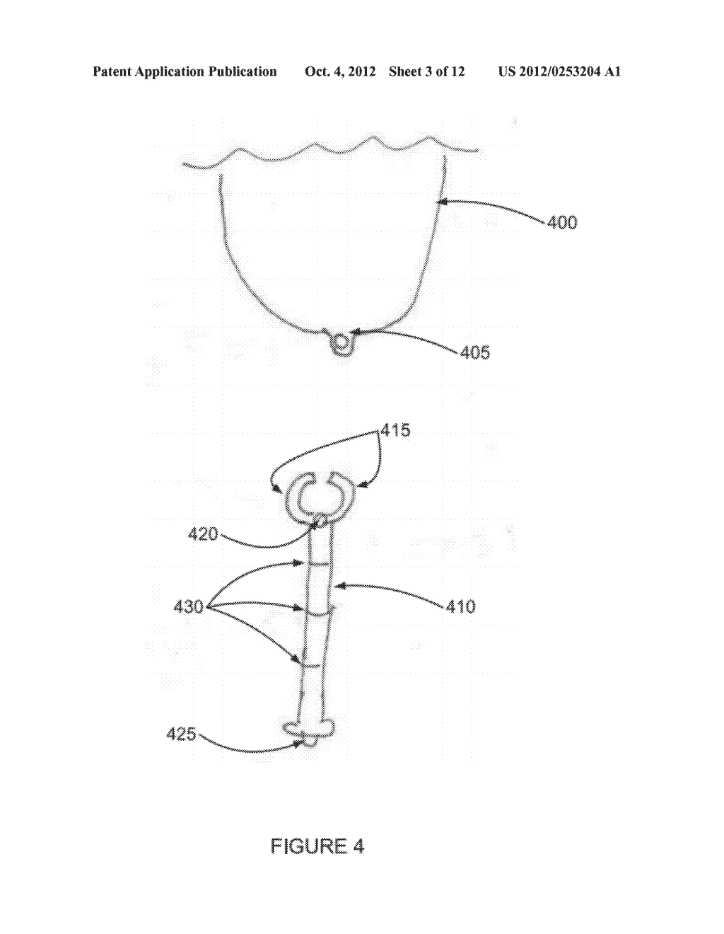 SYSTEMS AND METHODS FOR PHOTOTHERAPEUTIC TREATMENT OF RECTAL DISEASES - diagram, schematic, and image 04