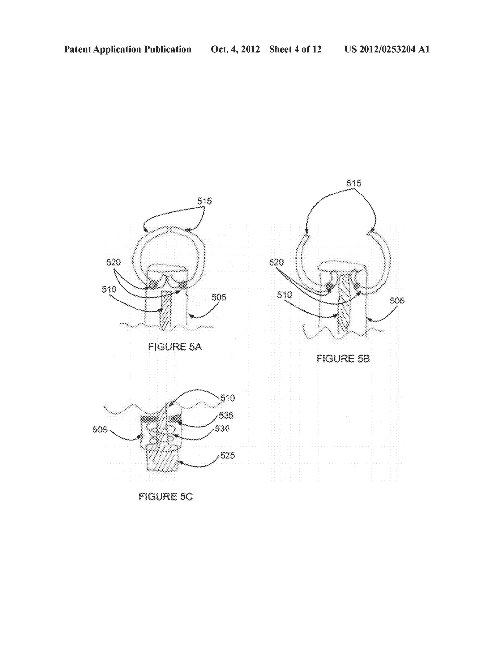 SYSTEMS AND METHODS FOR PHOTOTHERAPEUTIC TREATMENT OF RECTAL DISEASES - diagram, schematic, and image 05