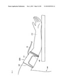 Cuff of Sphygmomanometer diagram and image