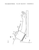 Cuff of Sphygmomanometer diagram and image