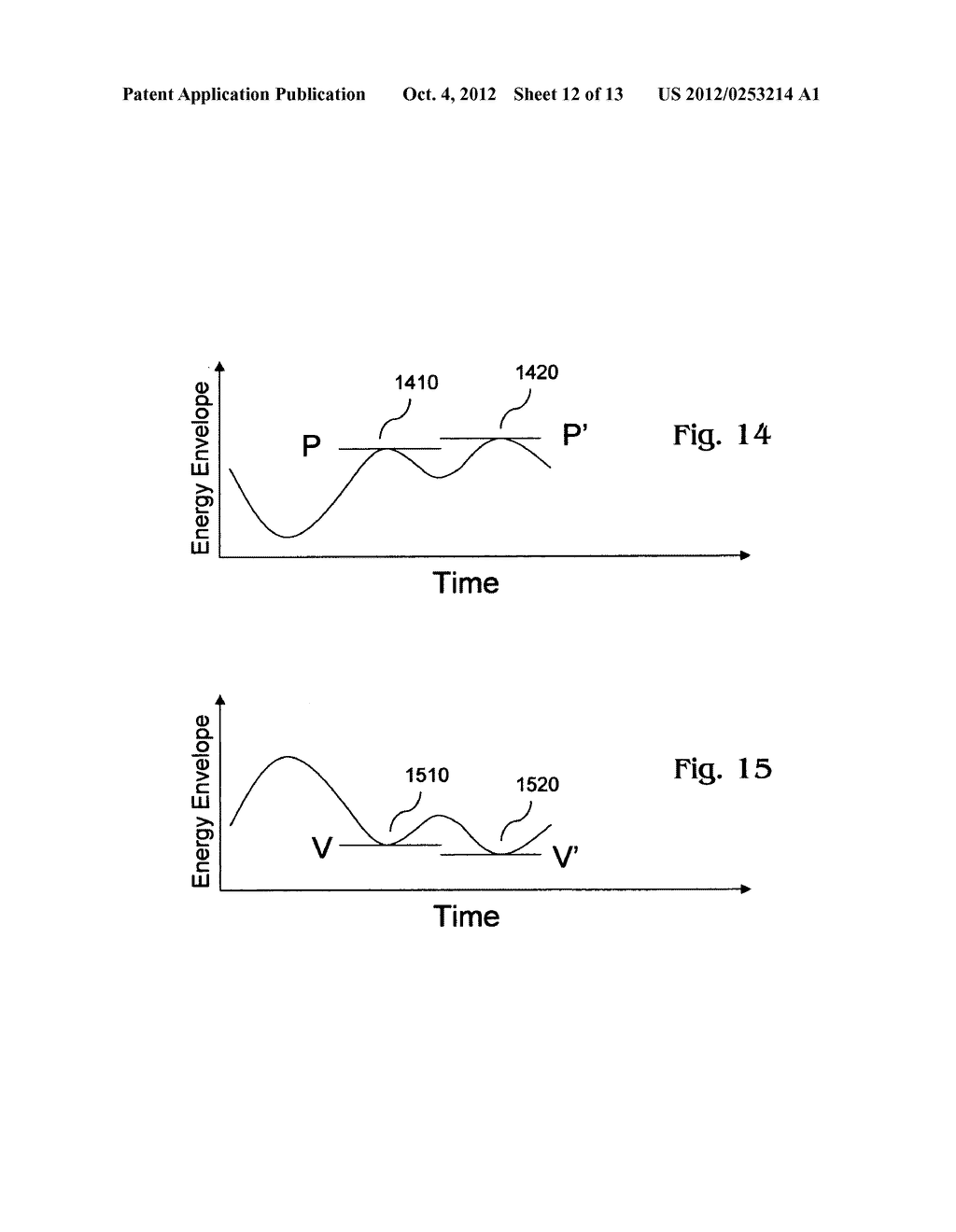 Multistage method and system for estimating respiration parameters from     acoustic signal - diagram, schematic, and image 13