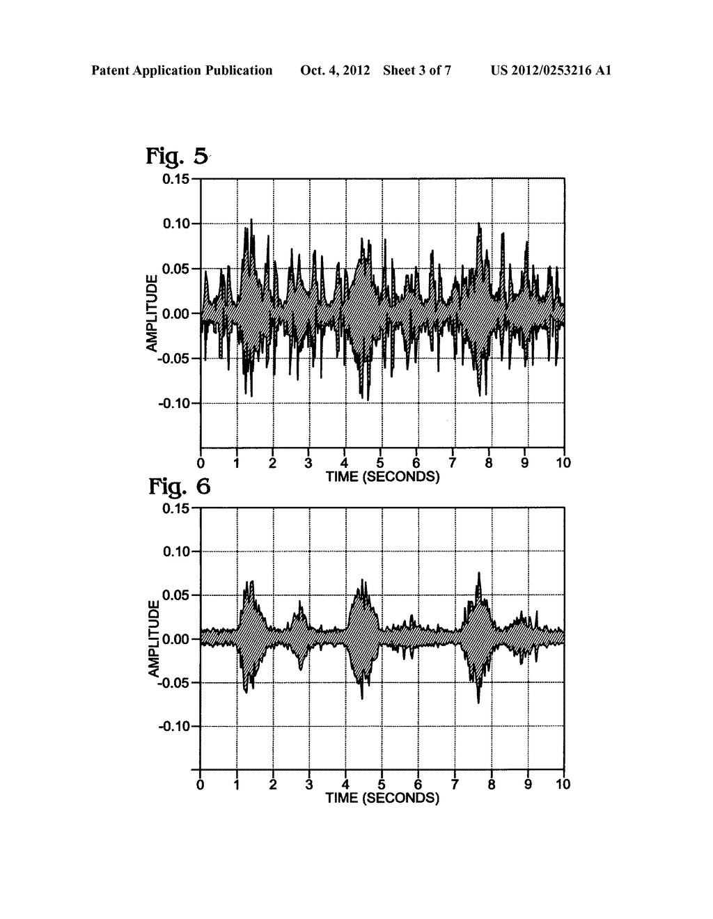 Respiration analysis using acoustic signal trends - diagram, schematic, and image 04