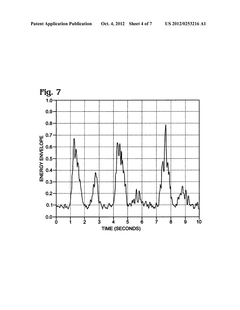 Respiration analysis using acoustic signal trends - diagram, schematic, and image 05