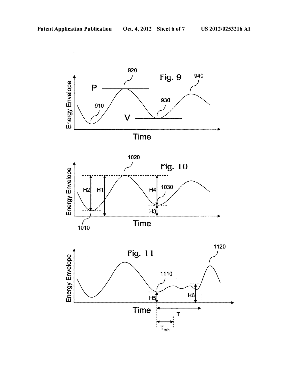 Respiration analysis using acoustic signal trends - diagram, schematic, and image 07