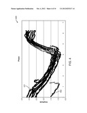 PREDICTION OF BREATHING SIGNAL AND DETERMINING NON-PERIODICITY OF     BREATHING USING SIGNAL-PHASE HISTOGRAM diagram and image