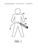 ASPIRATION BIOPSY APPARATUS AND METHOD diagram and image