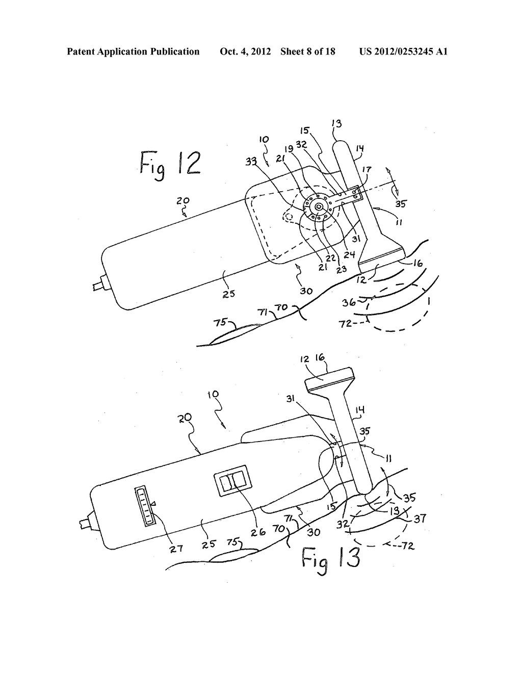 Therapeutic device and method for scar tissue therapy having intermediate     and opposed heads - diagram, schematic, and image 09