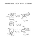 Therapeutic device and method for scar tissue therapy having intermediate     and opposed heads diagram and image