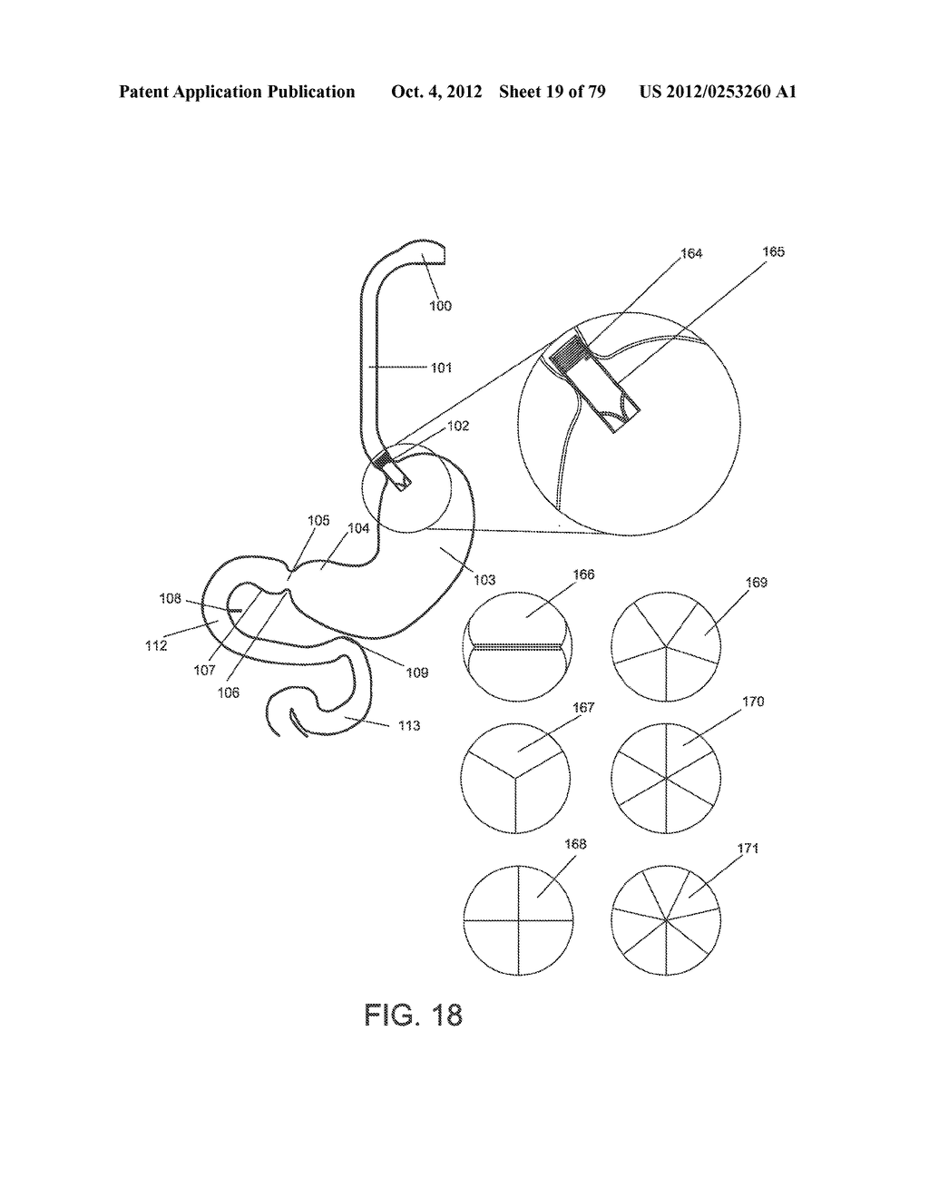 GASTROINTESTINAL PROSTHESES - diagram, schematic, and image 20