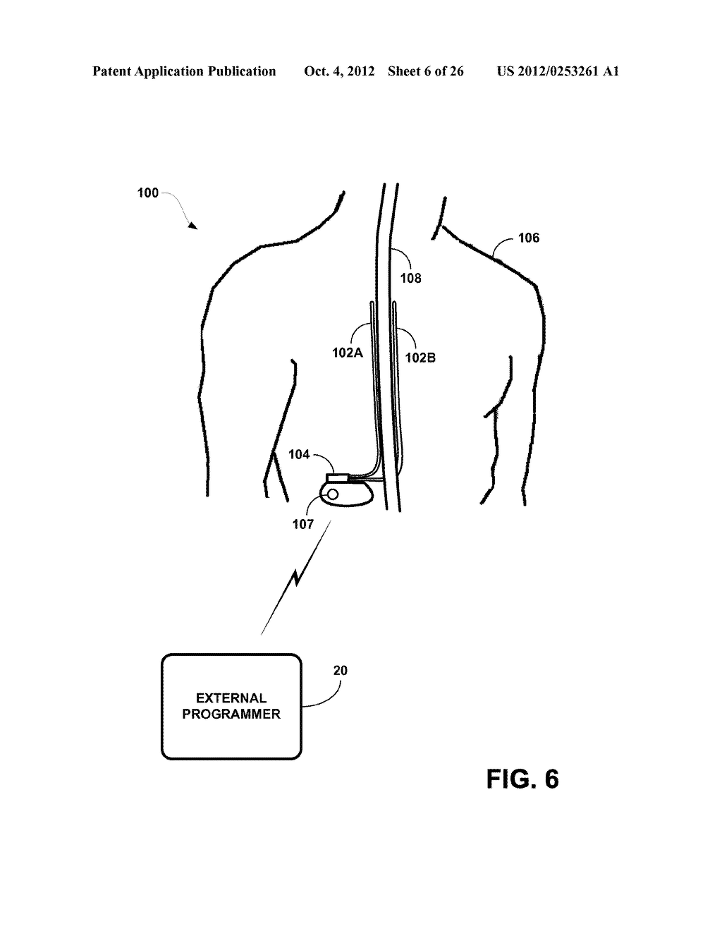 SYSTEMS AND METHODS FOR OPTOGENETIC MODULATION OF CELLS WITHIN A PATIENT - diagram, schematic, and image 07