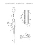 Extradural Infusion Suction System and Method to Drain Fluid Collection in     the Extradural Space of Spinal Cord diagram and image