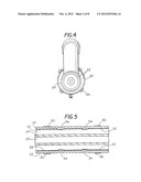 Extradural Infusion Suction System and Method to Drain Fluid Collection in     the Extradural Space of Spinal Cord diagram and image