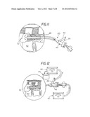 Extradural Infusion Suction System and Method to Drain Fluid Collection in     the Extradural Space of Spinal Cord diagram and image