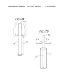 Extradural Infusion Suction System and Method to Drain Fluid Collection in     the Extradural Space of Spinal Cord diagram and image