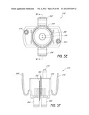 ANESTHETIC INJECTION SYSTEM diagram and image