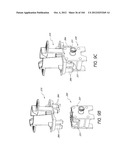 ANESTHETIC INJECTION SYSTEM diagram and image